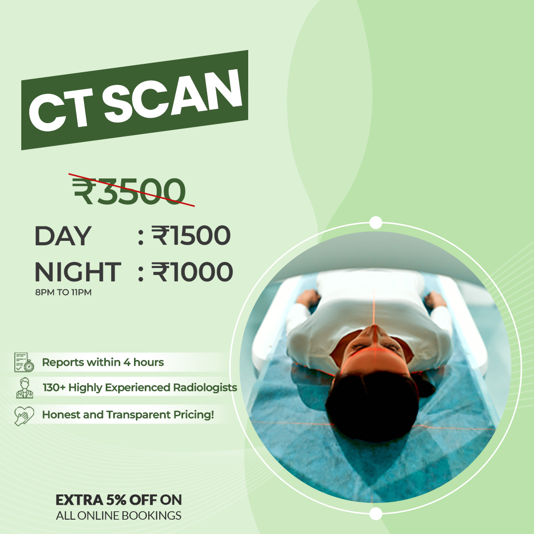 CT SCAN Aarthi Scans and Labs