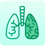 CT Pulmonary Angiogram Scan
