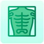 X-ray Abdomen AP View